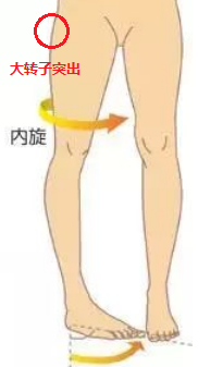 你所不知道的“假胯宽”