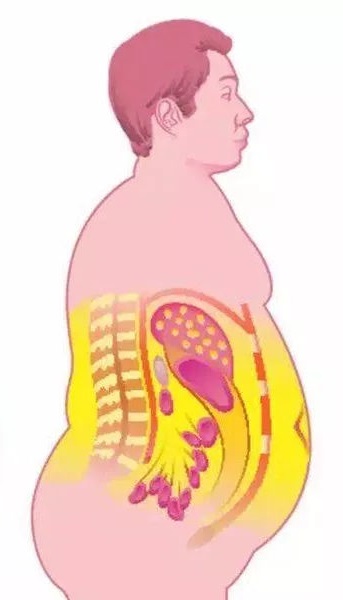你的骨盆前倾可能是因为你超标的BMI